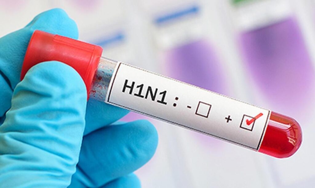 2079552-h1n1